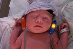 An electro-physiological hearing test on a newborn baby. 